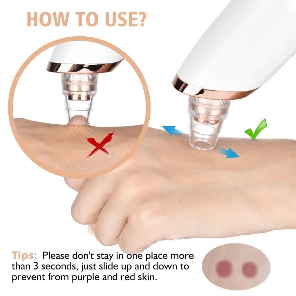 Rechargeable Blackhead Remover Vacuum  Deep Pore Cleaner for Clear Skin
