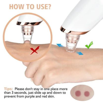 Rechargeable Blackhead Remover Vacuum  Deep Pore Cleaner for Clear Skin